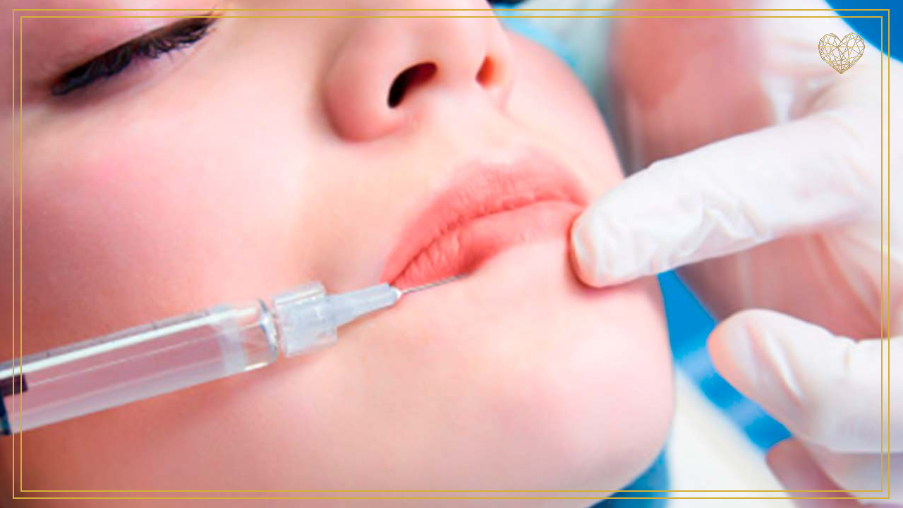Hidratación y perfilación de labios con ácido hialurónico