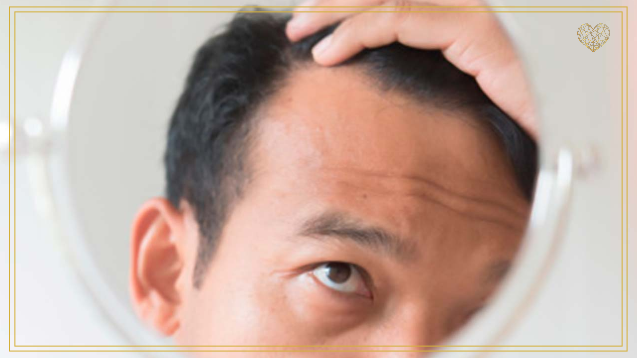 Manejo de la alopecia